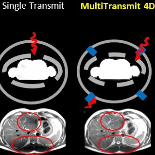 MultiTransmit 4D 1