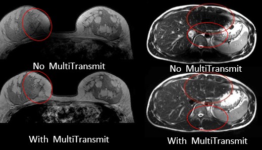 MultiTransmit 4D 2