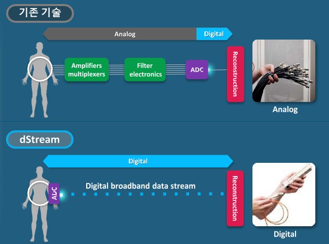 dStream 1